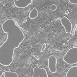 Capan-1 Cell Avalanche™ Transfection Reagent (human pancreas adenocarcinoma cell) product image