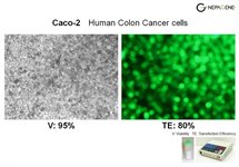 KM12 Cell Avalanche® Transfection Reagent (human colon adenocarcinoma cell) product image