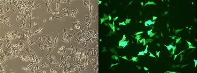 M14 (MDA-MB-435) Cell Avalanche® Transfection Reagent (human melanoma cell) product image