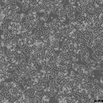 MDA-MB-468 Cell Avalanche™ Transfection Reagent (human breast carcinoma cell) product image