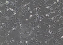 NCI-H1299 Cell Avalanche™ Transfection Reagent (human lung carcinoma cell) product image