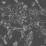 NCI-H1975 Cell Avalanche™ Transfection Reagent (human lung carcinoma cell) product image