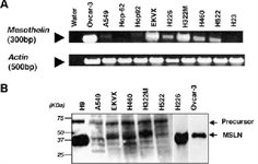 NCI-H322M Cell Avalanche® Transfection Reagent (human lung carcinoma cell) product image