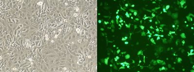 OVCAR-4 Cell Avalanche® Transfection Reagent (human ovary carcinoma cell) product image