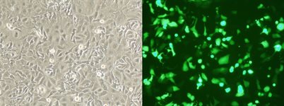 OVCAR-5 Cell Avalanche® Transfection Reagent (human ovary carcinoma cell) product image