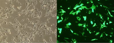 SK-MEL-28 Cell Avalanche™ Transfection Reagent (human melanoma cell) product image