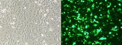 SK-OV-3 Cell Avalanche™ Transfection Reagent (human ovary carcinoma cell) product image