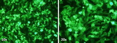 ZR-75-1 Cell Avalanche™ Transfection Reagent (human breast carcinoma cell) product image