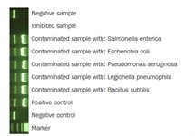 Onar&reg; Bacteria product image
