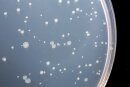 Ames Test Kit in Petri Dishes OECD TG471 - Ready to Use - MacroAmes1 - Penta 3 with 5 Strains product image